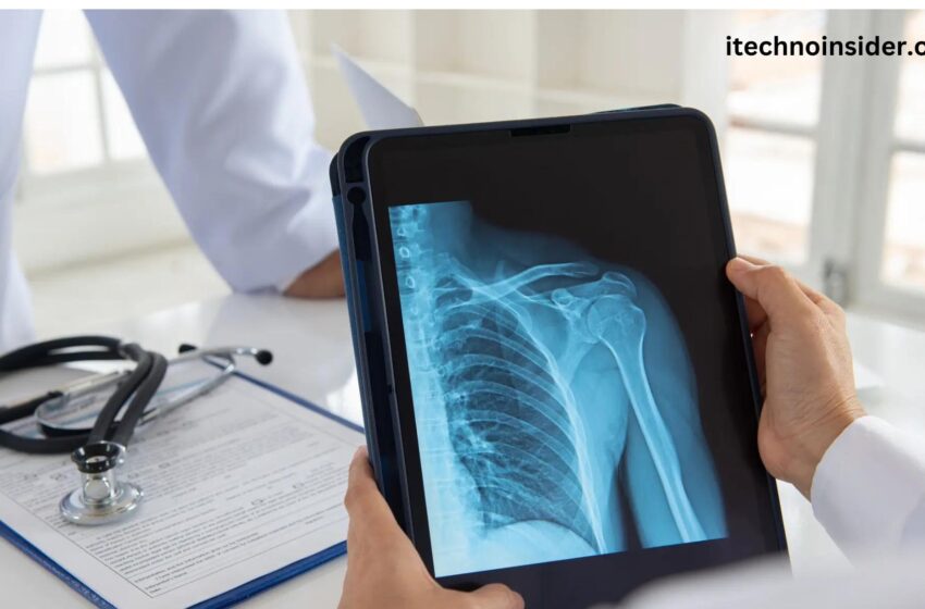  What is X-Rays?